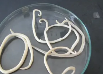 Bocah Sukabumi Meninggal Karena Cacing, Pakar Jelaskan Penyebab dan Cara Parasit Masuk Tubuh