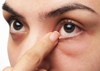 Gejala Penyakit Ginjal yang Muncul di Mata dan Penjelasannya