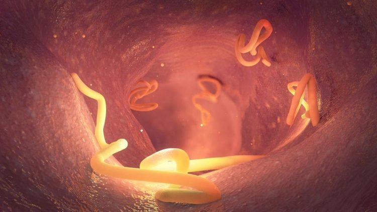 Sebelum Meninggal, Balita Sukabumi Mengeluarkan 1 Kg Cacing dari Tubuhnya