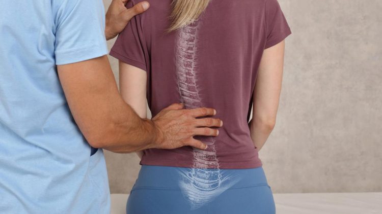 Mengatasi Skoliosis dengan Langkah Pencegahan dan Penanganan yang Tepat