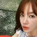 Yoon Eun Hye Ceritakan Hampir Buta karena Pernah Disiram Air Keras