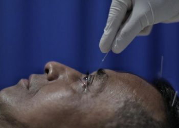 Manfaat Terapi Akupunktur Medik yang Perlu Diketahui