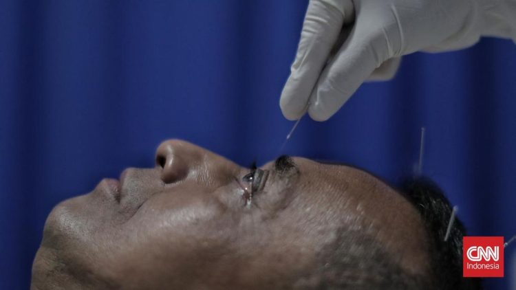 Manfaat Terapi Akupunktur Medik yang Perlu Diketahui