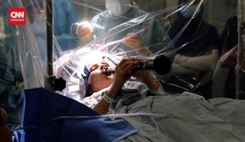 Penderita Parkinson Bermain Klarinet Selama Operasi Otak