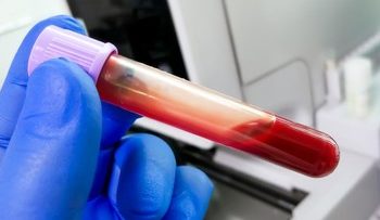 Golongan Darah Paling Langka di Dunia dan Penjelasan Tentang Golden Blood