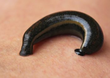 Mimisan Berkepanjangan, Lintah Ditemukan Bersarang di Hidung Seorang Pria