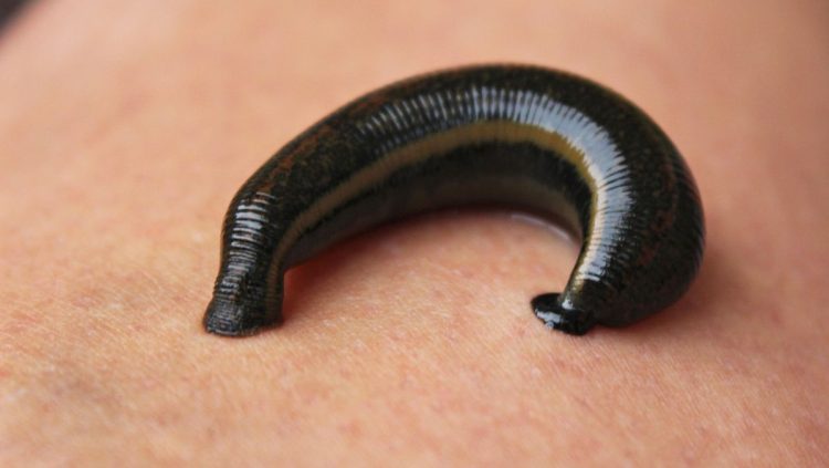 Mimisan Berkepanjangan, Lintah Ditemukan Bersarang di Hidung Seorang Pria