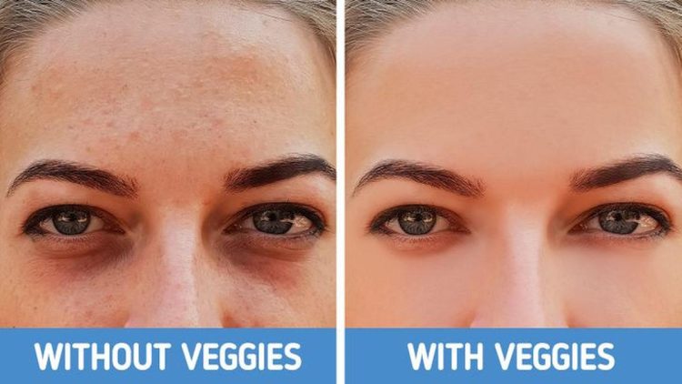 4 Jenis Lingkaran Hitam di Bawah Mata dan Cara Mengatasinya secara Tepat