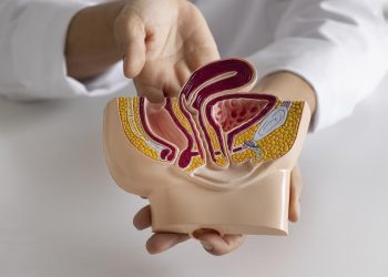 5 Pola Makan dan Gaya Hidup Pemicu Wasir atau Ambeien Menurut Dokter