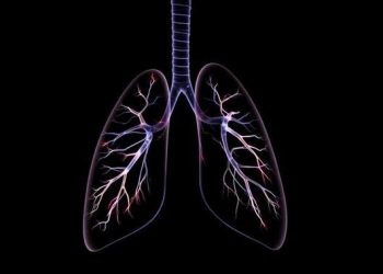 Emboli Paru Mematikan Seketika Diawali Bekuan Darah